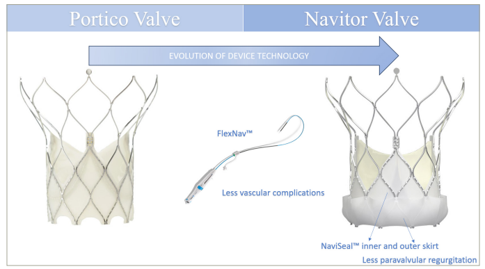 Figure 1: Evolution of device technology from the Portico™ to the Navitor™ valve